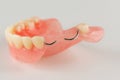 Acrylic denture with metal clasps