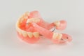 Acrylic denture with metal clasps