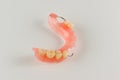 Acrylic denture with metal clasps