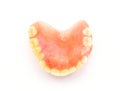 Acrylic denture with metal clasps