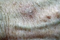 Actinic Keratoses