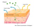 Action of eczema on skin