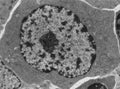 Activated B lymphocyte, TEM