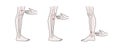 Active acupuncture points on the legs: above the knee, below the knee, above the ankle