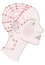 Active acupuncture points on the profile template on the back of the head. Girl with shaved bald hairless head and a beautiful