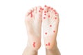 Acupressure of female feet