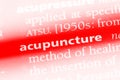 acupuncture