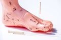 Acupuncture demonstration on foot model Royalty Free Stock Photo