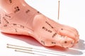 Acupuncture demonstration on foot model