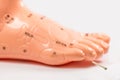 Acupuncture needle in acupuncture foot model