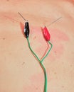 Acupuncture needles treatment with electrical wires / stimulator on Caucasian skin. Traditional Chinese acupuncture. Royalty Free Stock Photo