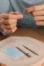 Acupuncture treatment on man`s hands, needles.