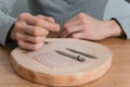 Acupuncture treatment on man`s hands, needles.