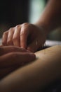 Close-up of Acupuncture Needles Inserted into Skin with Hands Placed on Top