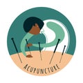 Acupuncture. Woman acupuncturist performs acupuncture procedure.