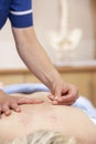 Acupuncturist treating female client Royalty Free Stock Photo