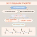 Acute coronary syndrome. Schematic Electrocardiogram of myocardial infarction (heart attack Royalty Free Stock Photo