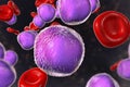 Acute lymphoblastic leukemia