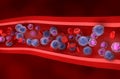 Acute myeloid leukemia (AML) cells in blood flow - isometric view 3d illustration