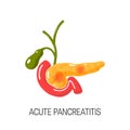 Acute pancreatitis concept. Vector illustration Royalty Free Stock Photo