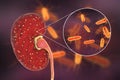 Acute pyelonephritis, medical concept, and close-up view of bacteria Escherichia coli