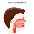 Adenoid location. Lymphatic system Royalty Free Stock Photo