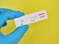 Adenovirus positive test result Royalty Free Stock Photo