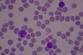 Adequate of platelet in blood smear
