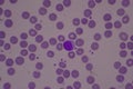 Adequate of platelet in blood smear