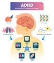 ADHD vector illustration. Labeled mind attention deficit disorder scheme. Royalty Free Stock Photo