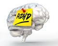 Adhd yellow note on brain