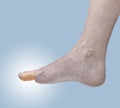 Adhesive Healing plaster on foot finger. Royalty Free Stock Photo