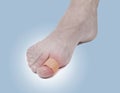 Adhesive Healing plaster on foot finger. Royalty Free Stock Photo