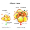 Adipocytes, obesity, and inflammation. normal, and obese adipose tissue Royalty Free Stock Photo