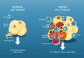 Adipose tissue and Obesity and inflammation. Close-up of a Fat cells Royalty Free Stock Photo