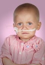 Adorable baby without hair beating the disease Royalty Free Stock Photo