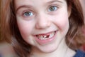 The adorable girl smiles with the fall of the first baby teeth. Royalty Free Stock Photo