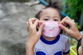 Adorable little child girl with big capillary strawberry hemangiomas red birthmark on head refuses to wear medical face mask
