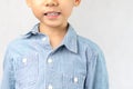 Adorable little kindergarten Asian boy buttons the first button wrong by mistake and smile Royalty Free Stock Photo