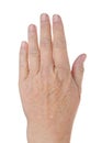 Top view very dry hand cracked dry skin Royalty Free Stock Photo