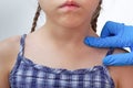 Adult finger in glove showing birthmark on child neck