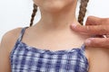 Adult finger showing birthmark on child neck