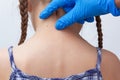 Adult fingers in glove showing birthmark on child neck back
