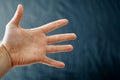 Adult hand with Raynaud`s Syndrome - Phenomenon. Close up hand with fingers on dark background with copy space