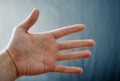 Adult hand with Raynaud`s Syndrome - Phenomenon. Close up hand with fingers on dark background with copy space