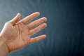 Adult hand with Raynaud`s Syndrome - Phenomenon. Close up hand with fingers on dark background with copy space