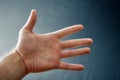 Adult hand with Raynaud`s Syndrome - Phenomenon. Close up hand with fingers on dark background with copy space