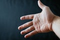 Adult hand with Raynaud`s Syndrome - Phenomenon. Close up hand with fingers on dark background with copy space