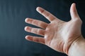 Adult hand with Raynaud`s Syndrome - Phenomenon. Close up hand with fingers on dark background with copy space