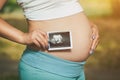 Adult pregnant woman holding a photo Medical ultrasound near the